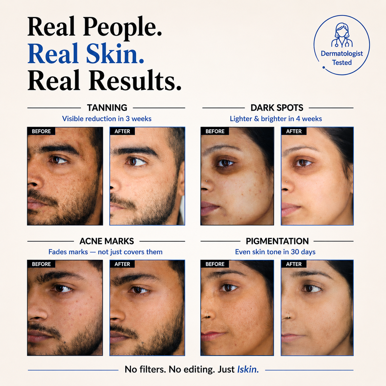 lskin. Rice Essence Skin Brightening Serum for Him