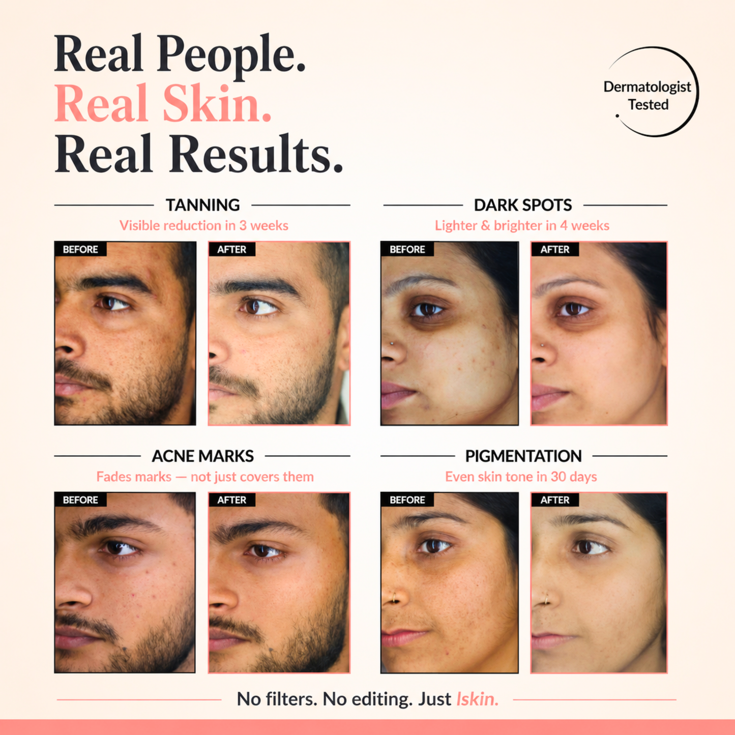 lskin. Rice Essence Skin Brightening Serum