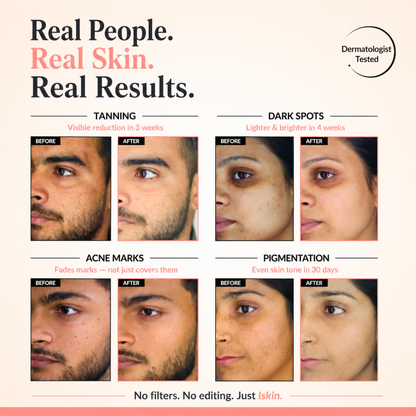 lskin. Rice Essence Skin Brightening Serum